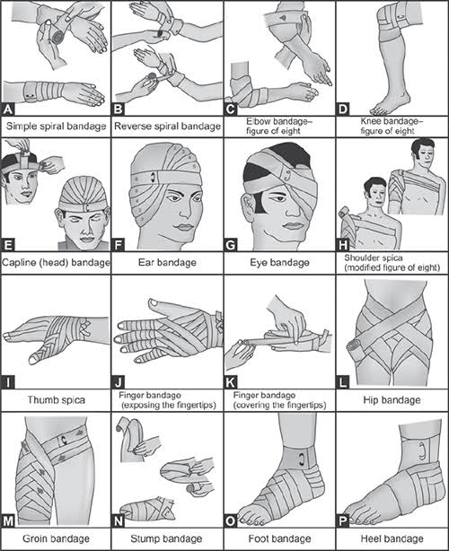 Specific gauze bandages