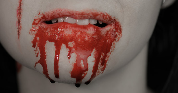 Blood dripping from mouth